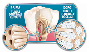 Tubuli dentinali